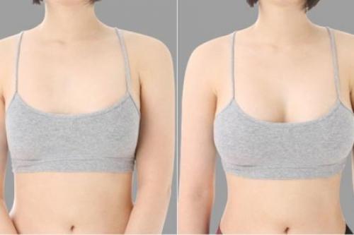 Важные вещи, которые нужно знать перед увеличением груди