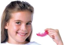 Капы для выравнивания зубов: плюсы