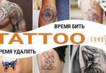Татуировки и способы их удаления