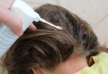 Проверенные методы выведения вшей