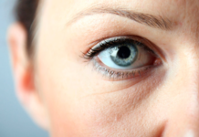 Как избавиться от мешков под глазами: лечение и профилактика