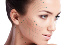 Особенности процедуры вживления мезонитей