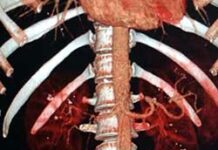 Что показывает КТ брюшной полости?