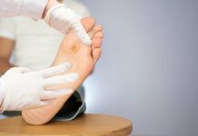 Трофическая язва