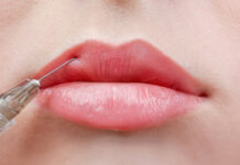 Что нужно знать, если ты решила увеличить губы