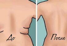 Как убрать жир со спины у женщин?