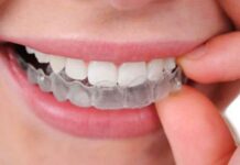 Исправление прикуса у детей: способы, особенности