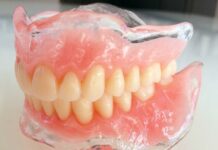 Акриловые зубные протезы: плюсы и минусы