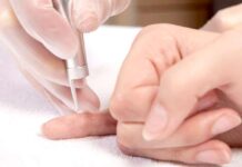 Лазерное удаление бородавок – эффективно и безболезненно