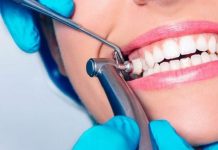 Что включает в себя гигиеническая чистка зубов?