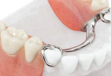 Зачем нужно протезирование зубов?