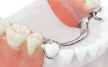 Зачем нужно протезирование зубов?