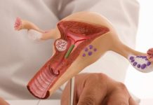 Как действует Мирена на организм?