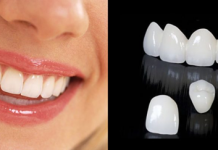 Преимущества и недостатки циркониевых коронок