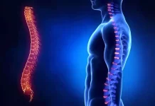 Самые распространенные заболевания позвоночника