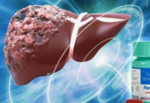 Можно ли навсегда избавиться от гепатита?