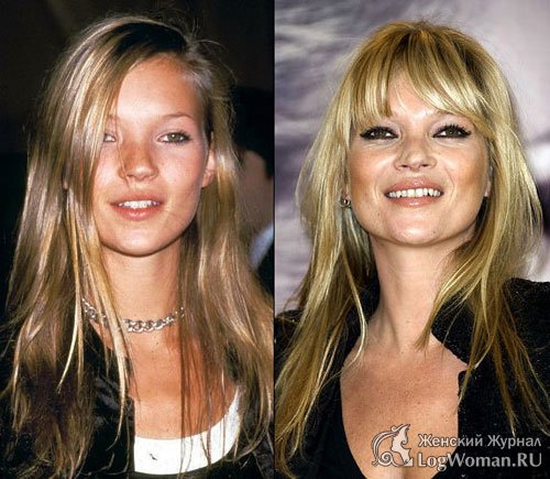 Время против звёзд Время против звёзд