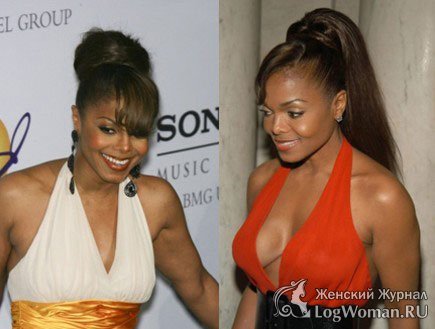 Звёзды До и После пластической операции Звёзды До и После пластической операции