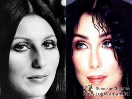 Звёзды До и После пластической операции Звёзды До и После пластической операции