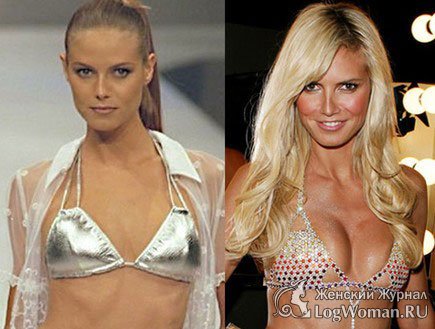 Звёзды До и После пластической операции Звёзды До и После пластической операции