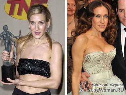 Звёзды До и После пластической операции Звёзды До и После пластической операции