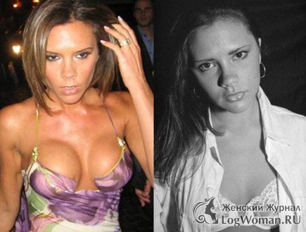 Звёзды До и После пластической операции Звёзды До и После пластической операции