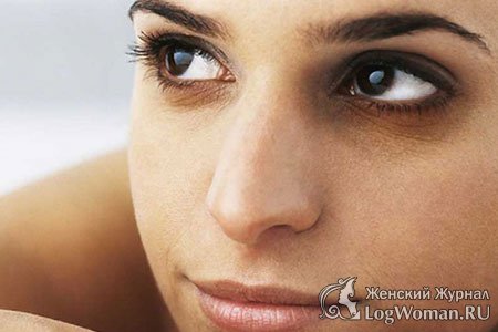 Темные круги под глазами