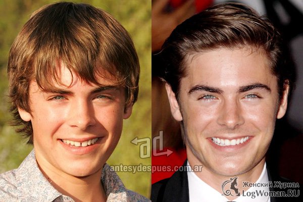 Зак Эфрон Зак Эфрон