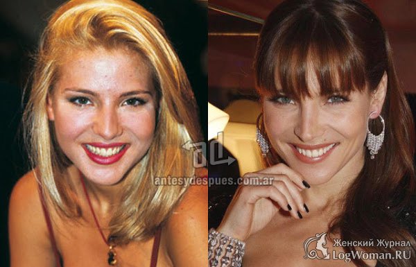 Эльза Патаки Эльза Патаки