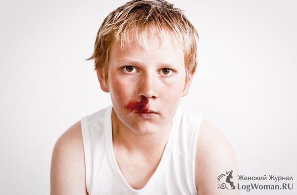 Кровь из носа у ребенка Кровь из носа у ребенка