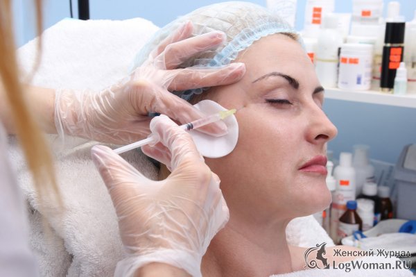 Этапы проведения биоревитализации лица Этапы проведения биоревитализации лица