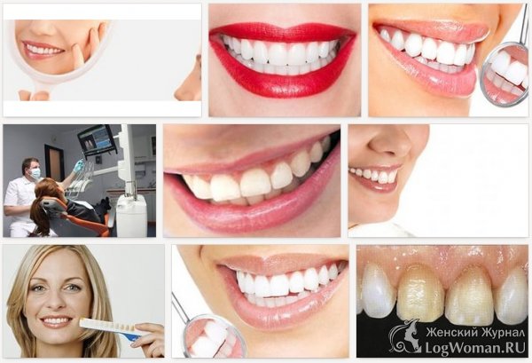 Разновидности эстетической стоматологии Разновидности эстетической стоматологии