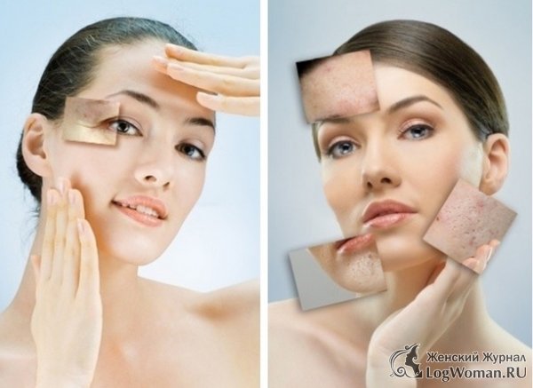 Особенности лазерного пилинга Особенности лазерного пилинга