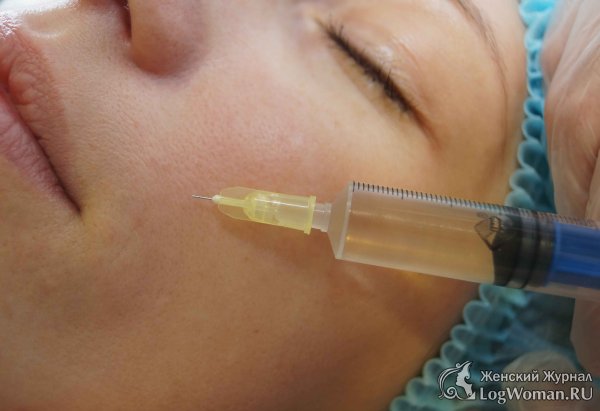 Этапы процедуры плазмолифтинг лица Этапы процедуры плазмолифтинг лица