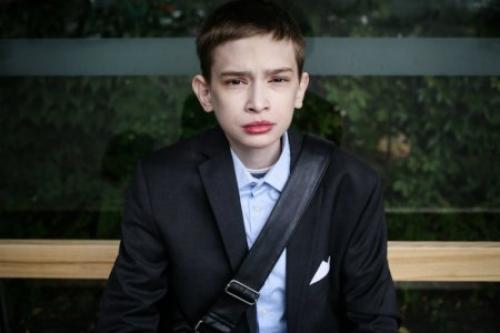 Из-за болезни 25-летний мужчина похож на мальчика