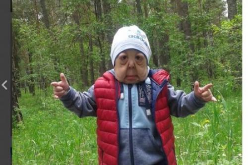 В Казахстане живёт 6-летний мальчик, который похож на старика