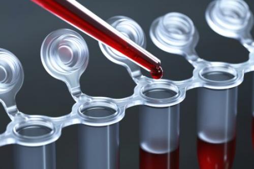 Как правильно подготовиться к анализу крови?