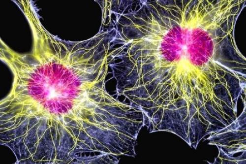 Стволовые клетки впервые использовали для лечения болезни Паркинсона