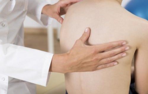 Искривление позвоночника — причины, симптомы и лечение болезни