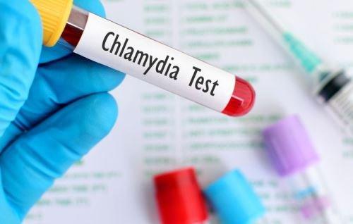 Хламидиоз — причины, симптомы и лечение болезни